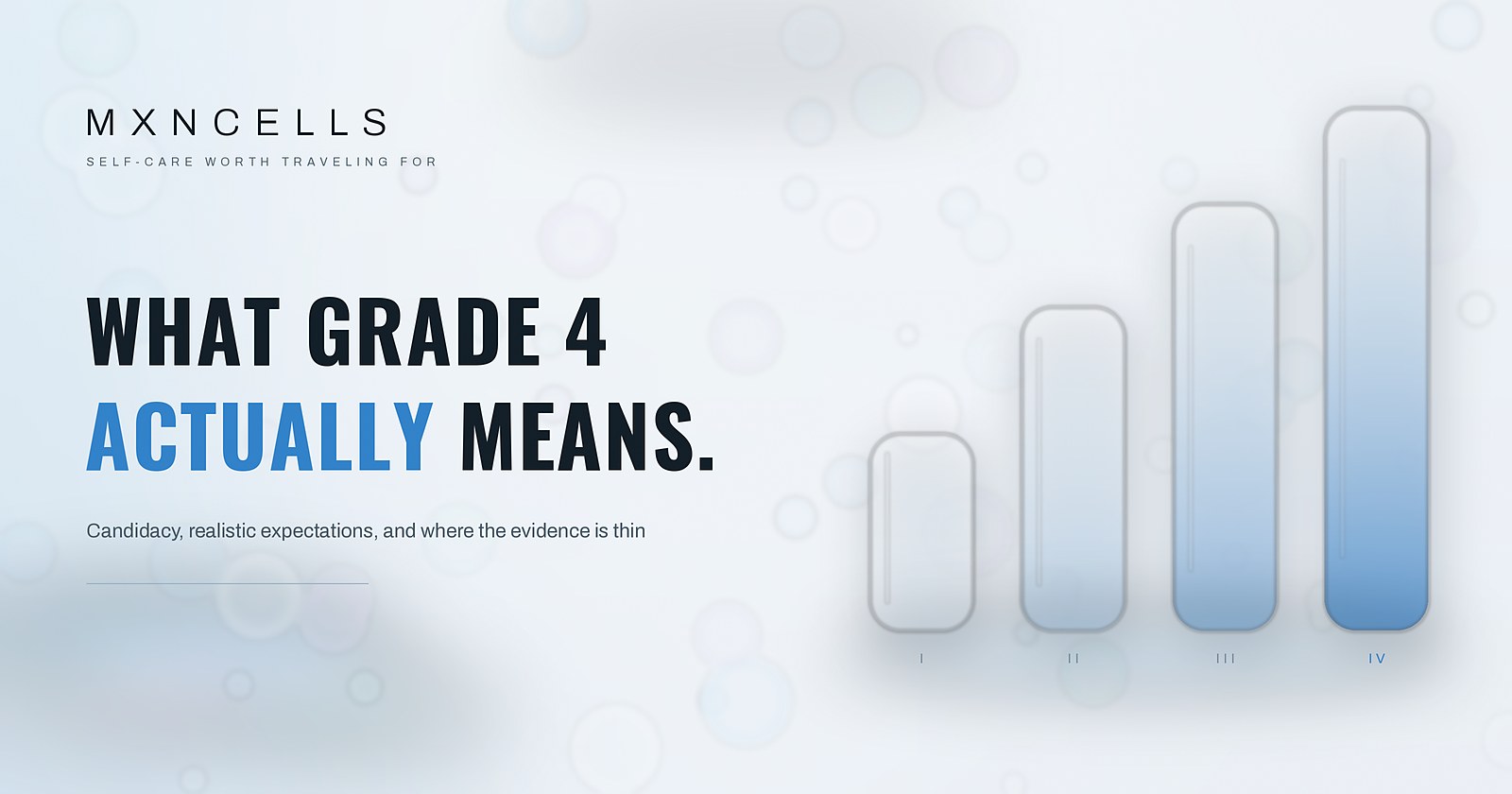 Four pearlescent glass columns rising in height and deepening in blue, labelled I to IV, representing the osteoarthritis grading scale